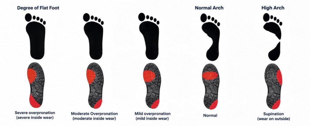 shoe wear pattern